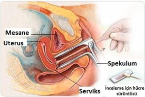 Smear testi nedir?