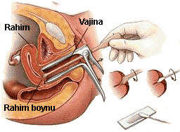 Smear testi nasıl yapılır?