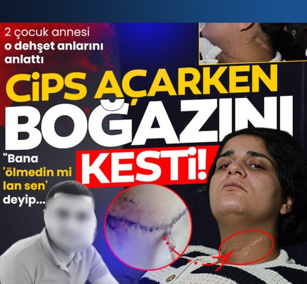 Adana’da akılalmaz vahşet! Eski eşi boğazını kesti, yüzde 96 engelli kaldı! O dehşet anlarını anlattı